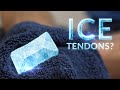 Should You ICE Patellar Tendonitis?