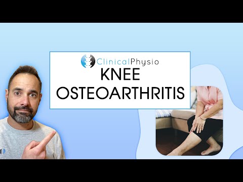 What is Knee Osteoarthritis OA? | Expert Physio Guides you through Anatomy, Diagnosis and Treatment