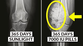 THIS Is Why Vitamin D Supplements AREN'T The Same As Sunlight screenshot 3