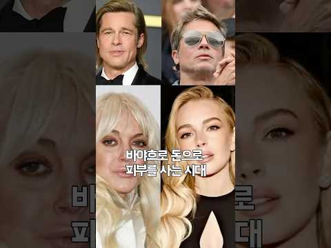젊어지는 시술 그게 뭔데?