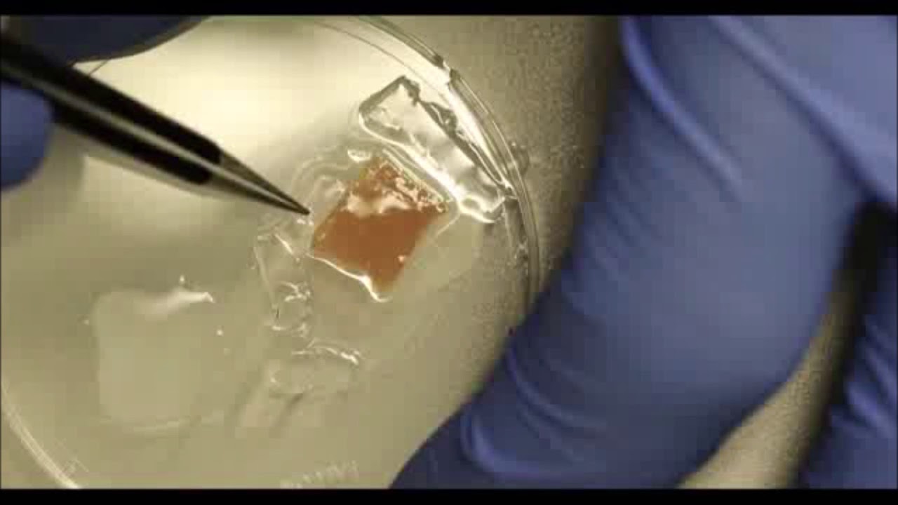 Long-term functional and structural preservation of precision-cut human myocardium under continuous