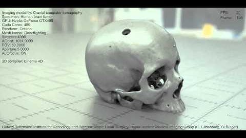GPU-Medical Visualization  1 (Skull)