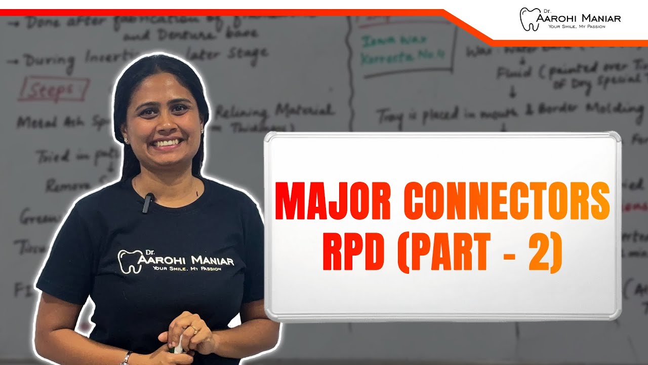 Major Connectors RPD part 2 - YouTube