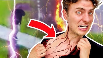 I GOT STRUCK BY LIGHTNING! (Lucky to be Alive)