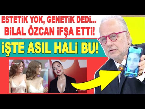 Hilal Altınbilek estetik açıklaması olay yarattı! Bilal Özcan estetiksiz halini gösterip ayar verdi!