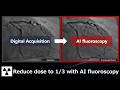 (Highlight) Activating AI for DA-Less procedures - A new chapter for interventional cardiology