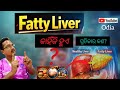 Fatty liver କାହିଁକି ହୁଏ l ଏହାର ଲକ୍ଷଣ ଏବଂ ଚିକିତ୍ସା କଣ ରହିଛି #healthtips #fattyliver 