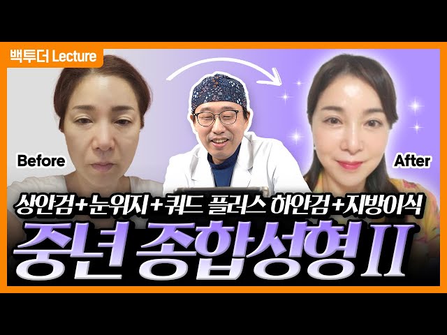 오직 40대 50대를 위한, 중년 종합성형 세트! 과연 어떻게 변했을까요?