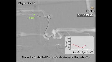 [Telerobotic Stroke Intervention] Supporting Movie S7