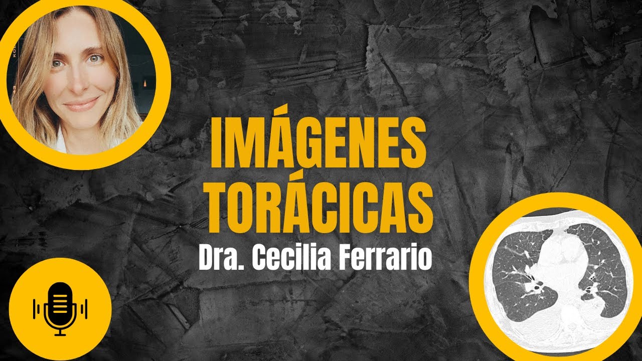 ¿Cómo la IA está Cambiando el Diagnóstico Médico en 2025?