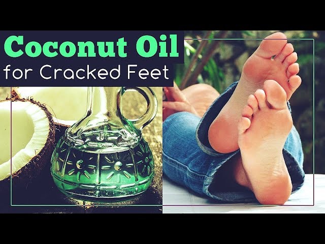 Coconut Oil Cracked Heels - Temu