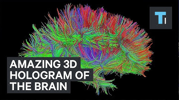 3D hologram of the brain’s connections