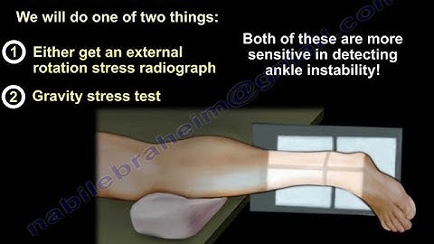 Ankle Fracture , Stress View Radiographs - Everything You Need To Know - Dr. Nabil Ebraheim