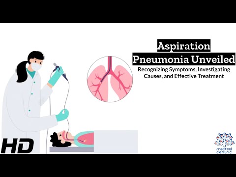 Aspiration pneumonia Information