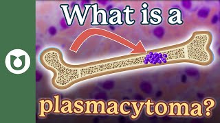 What is a plasmacytoma?