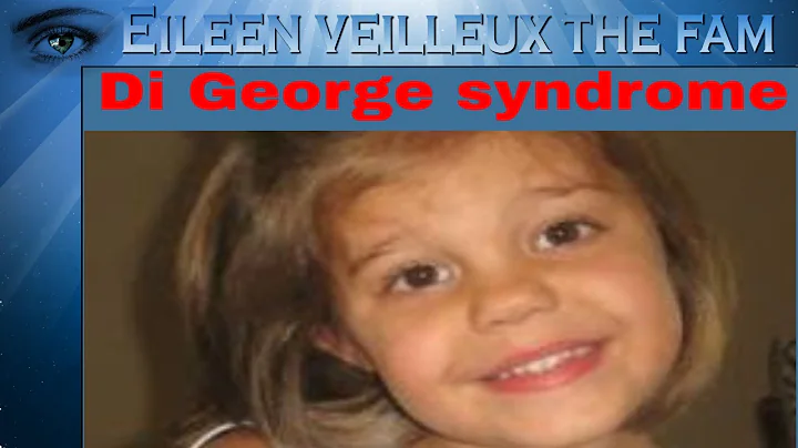 Di George syndrome Eileen Veilleux The Fam