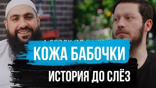 КОЖА БАБОЧКИ - УДИВИТЕЛЬНАЯ ИСТОРИЯ