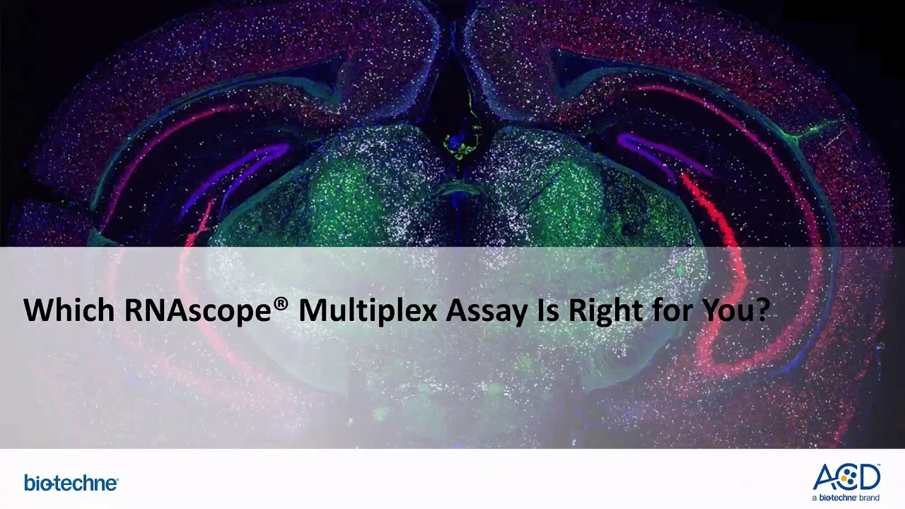 2018 Nov 27 Support Webinar