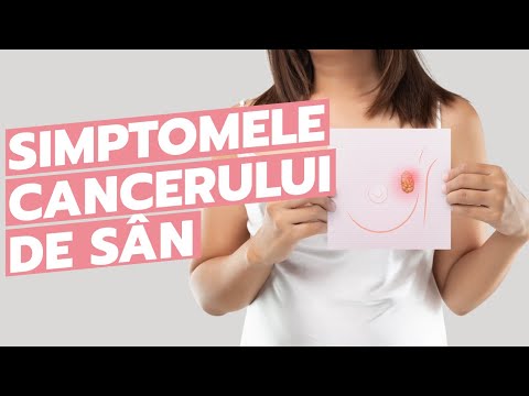 Video: Cancerul de sân în timpul sarcinii - tot ce trebuie să știți