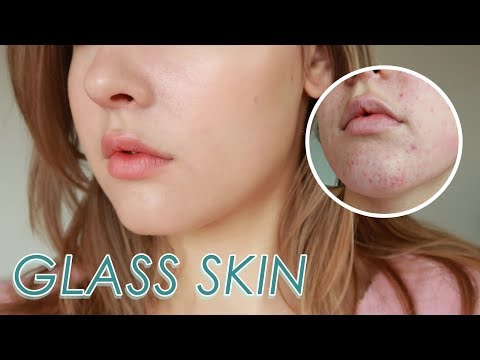 Glass skin Routine for Acne Prone Skin 💦