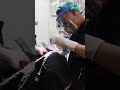 PROSES CABUT GIGI BUNGSU BERLUBANG!!!