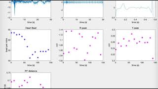 ECG signal processing module (1.7)