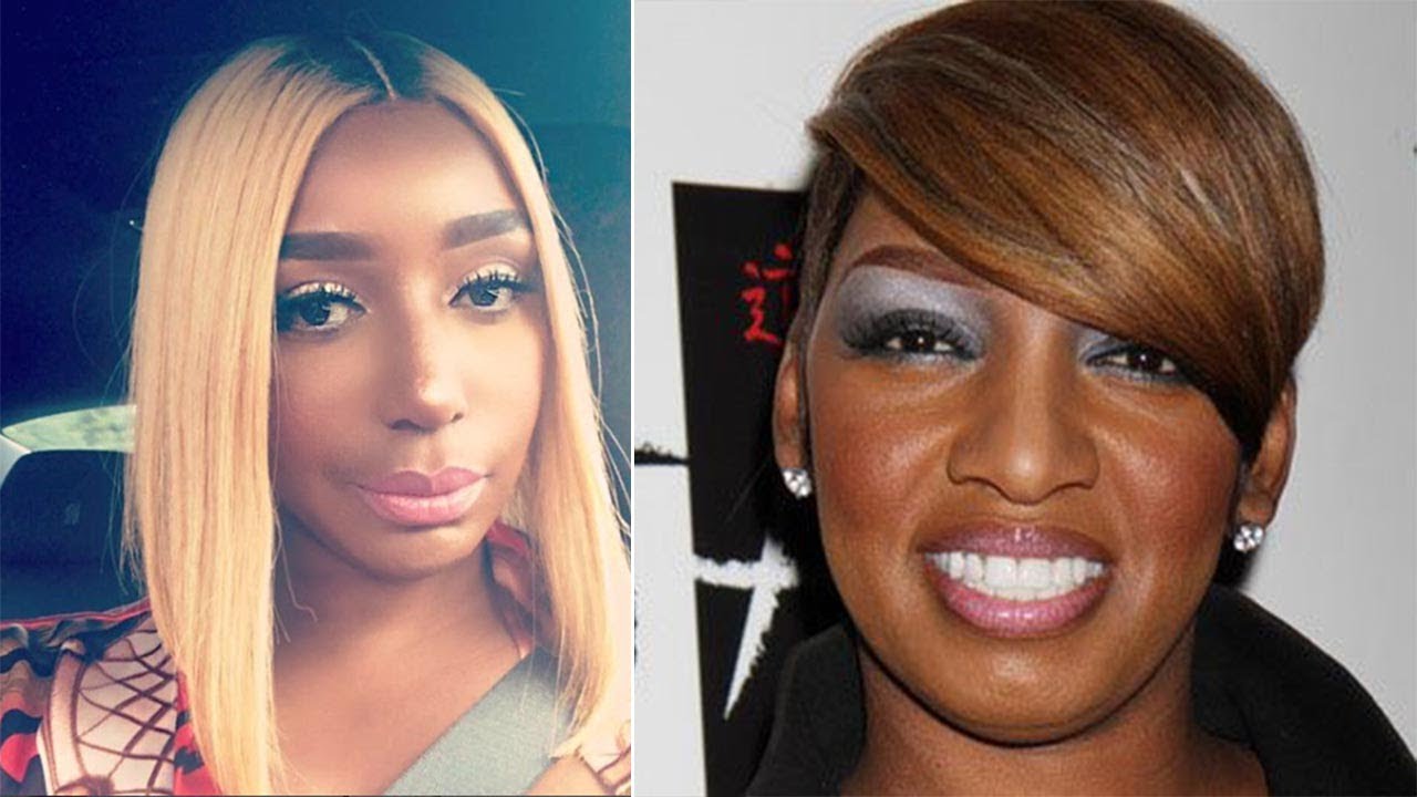 A fan told Nene Leakes to stop getting surgery done on her face, Nene