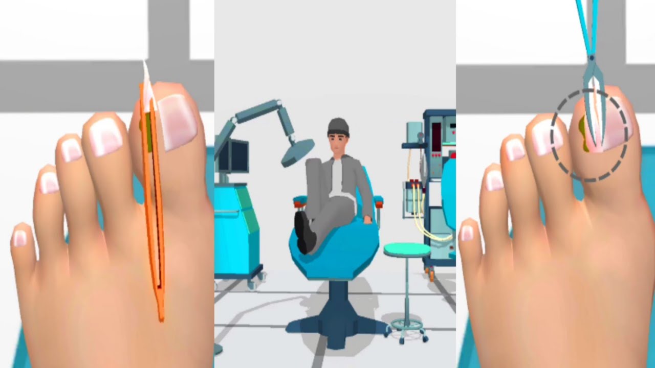 Foot Clinic Game - ASMR Feet Care Max Level Gameplay Android iOS Walkthrough Update Games