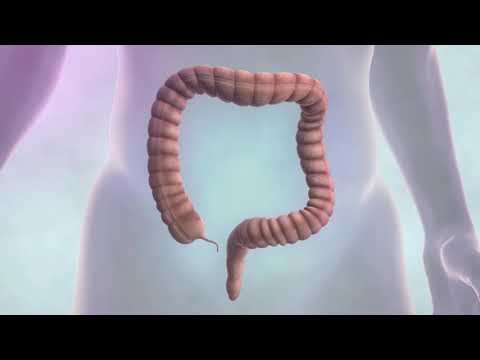 Vidéo: Atonie Intestinale - Symptômes, Traitement