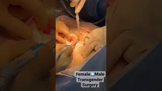 FTM Transgender TOP Chest Reconstruction Surgery by Dr. Seattle!