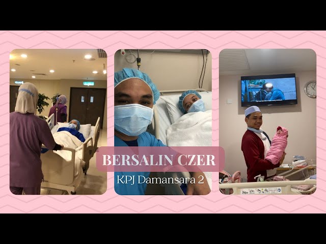 Pengalaman Bersalin Elective Czer Di KPJ Damansara Specialist Hospital 2 Bukit Lanjan class=