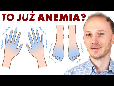 Czy to już anemia? Wczesne objawy anemii: 13 oznak, że warto się zbadać | Dr Bartek Kulczyński