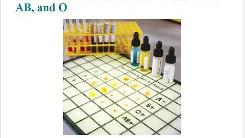 Forensic Science (College) - Forensic Serology (Chapter 15)