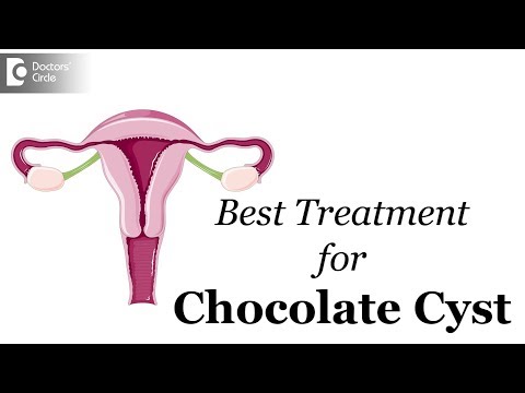 Video: Cyst Coklat (Endometrioma Ovari): Rawatan, Kesuburan, Dan Banyak Lagi