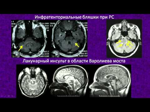 При сердечной недостаточности одышка как лечить 121
