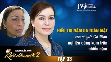 Điều trị nám da toàn mặt cho cô gái Cà Mau nghiện dùng kem trộn nhiều năm