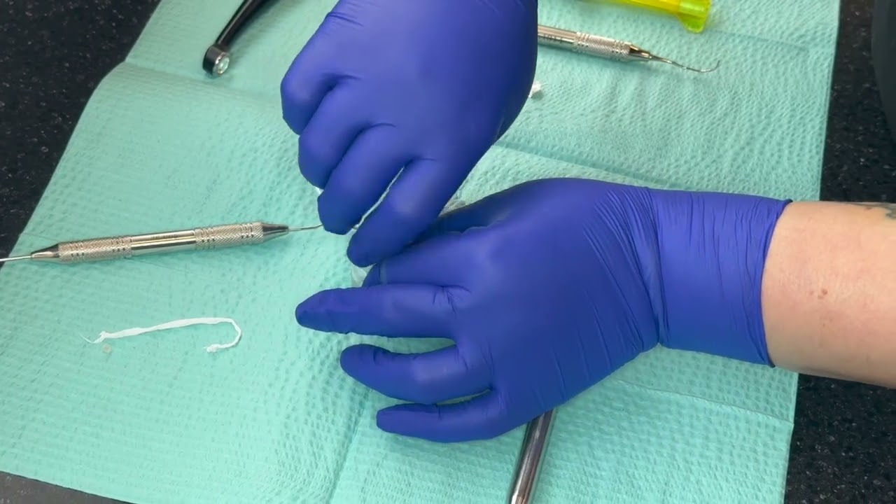 How to remove and replace temporary implant crowns by Lyon Dental Implants