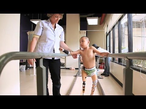 วีดีโอ: รายการความพิการทางร่างกายมีอะไรบ้าง?