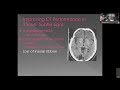 Stroke: The Role of CT and MRI in Diagnosis and Treatment