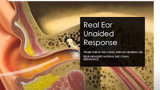 Real Ear Measurement and Speech Mapping with Ms. Amy Lennox