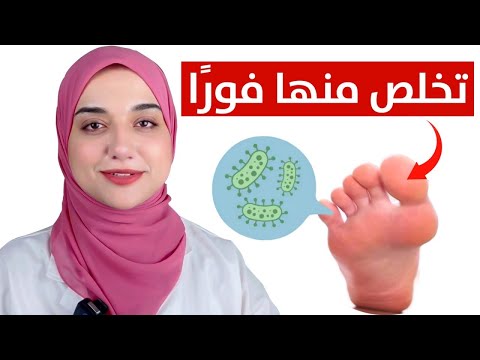 اسهل و اسرع طريقة للتخلص من رائحه القدمين الكريهه