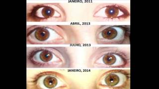 eye changes on raw food diet before and after