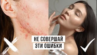 10 Ошибок В Уходе За Кожей Лица. Почему Появляются Прыщи?