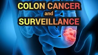 Colon Cancer and Surveillance  CRASH! Medical Review Series