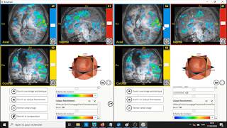 Tutoriels en SVT: Ouvrir des fichiers Anat et IRM fonctionnelles avec EduAnat2 et la base Neuropéda screenshot 5
