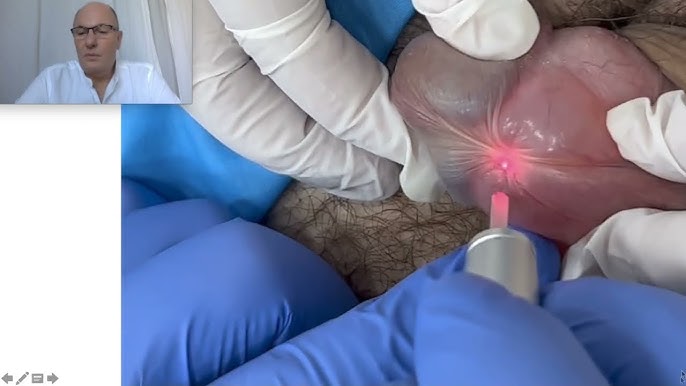 Boglangan ayol bilan jinsiy aloqa