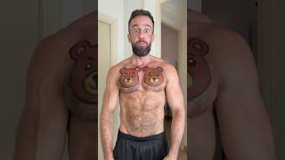 Can A Bear Bite Change Your Life Forever?
