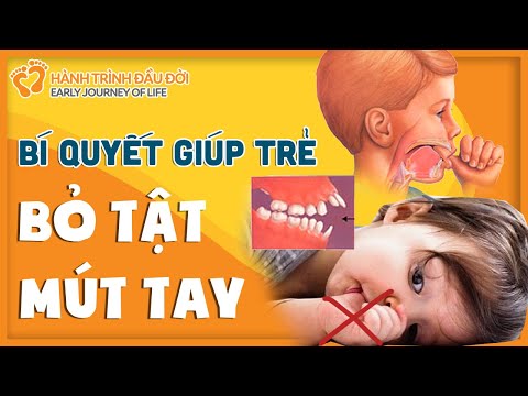 Video: Làm Thế Nào để Ngừng Mút Ngón Tay Cái