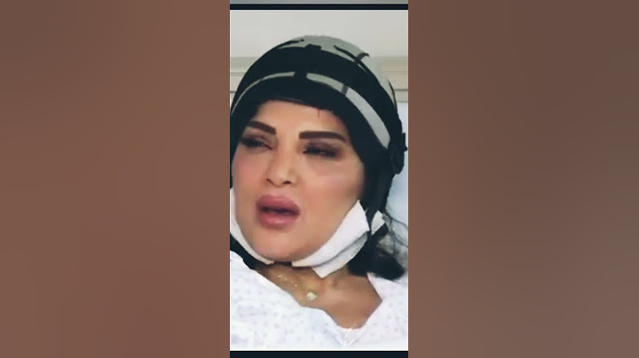 دينا حايك تفقد شعرها بسبب مرض السرطان