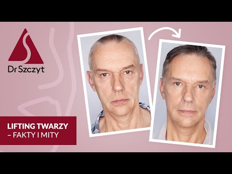 Wideo: Czy liftingi kiedykolwiek wyglądają naturalnie?